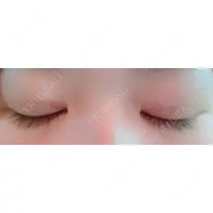 湘南美容クリニック 湘南美容クリニック 京都院口コミ