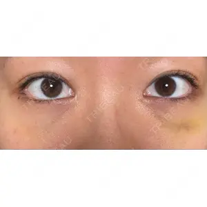 APOLLO BEAUTY CLINIC口コミ