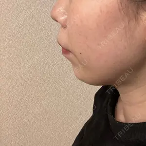 TCB東京中央美容外科 TCB東京中央美容外科 船橋院口コミ