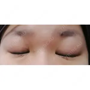 湘南美容クリニック 湘南美容クリニック 松山院口コミ