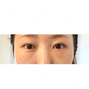 X CLINIC X CLINIC 銀座院口コミ