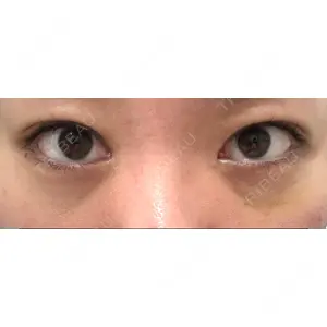 APOLLO BEAUTY CLINIC口コミ