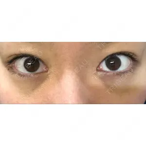 APOLLO BEAUTY CLINIC口コミ