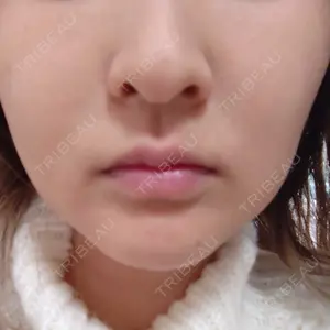 口コミ