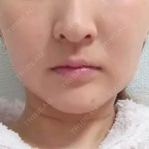 口コミ
