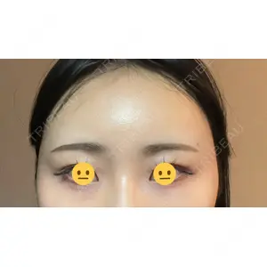 X CLINIC X CLINIC 銀座院口コミ