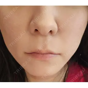 湘南美容クリニック 湘南美容クリニック 仙台院口コミ