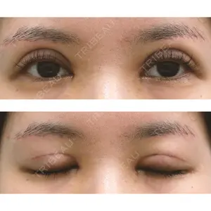 もとび美容外科クリニック 新宿院口コミ