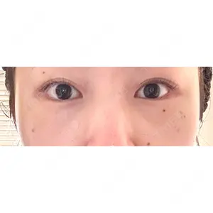 X CLINIC X CLINIC 銀座院口コミ