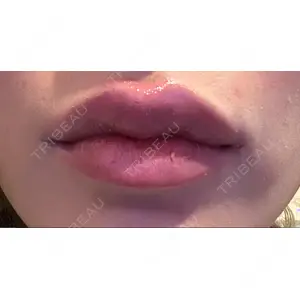 L‘amour clinic Tokyo【ラムールクリニック東京】口コミ