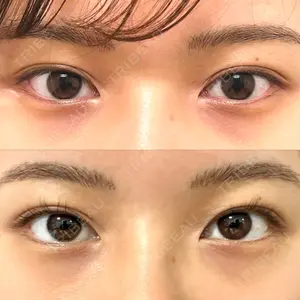 口コミ