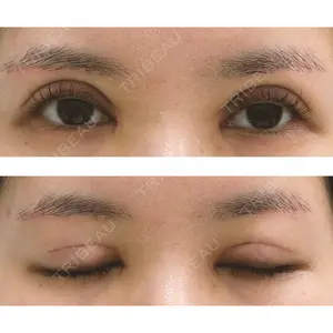 もとび美容外科クリニック 新宿院口コミ