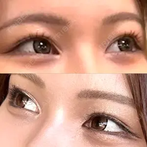 口コミ