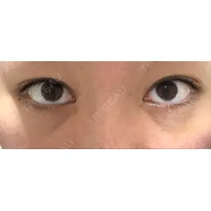 APOLLO BEAUTY CLINIC口コミ