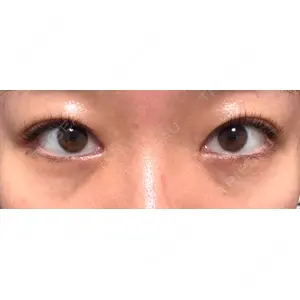 APOLLO BEAUTY CLINIC口コミ