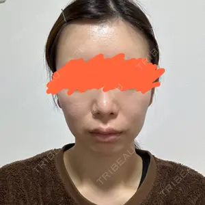 口コミ