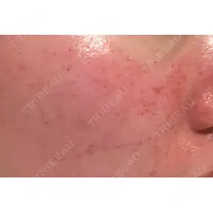 Re:anne clinic 銀座 【リアンクリニック銀座】口コミ