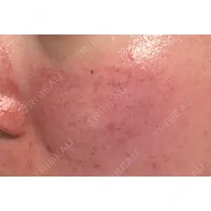 Re:anne clinic 銀座 【リアンクリニック銀座】口コミ