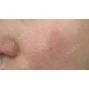 Re:anne clinic 銀座 【リアンクリニック銀座】口コミ