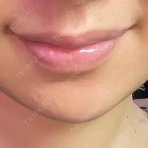 フィラークリニック フィラークリニック 町田院口コミ