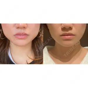 TCB東京中央美容外科 TCB東京中央美容外科 池袋駅前院口コミ