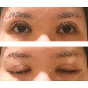 もとび美容外科クリニック 新宿院口コミ