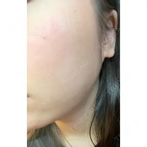 B-LINE CLINIC B-LINE CLINIC 池袋院口コミ