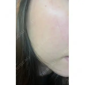 B-LINE CLINIC B-LINE CLINIC 池袋院口コミ