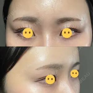 X CLINIC X CLINIC 銀座院口コミ
