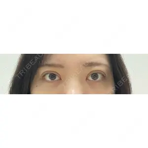 湘南美容クリニック 湘南美容クリニック 池袋東口院口コミ