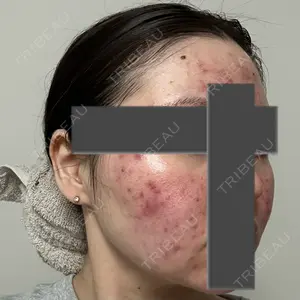 東京美容外科 東京美容外科 池袋院口コミ