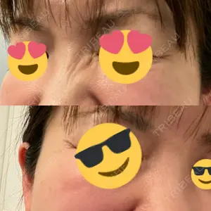 TCB東京中央美容外科 TCB東京中央美容外科 秋葉原院口コミ