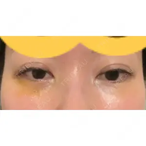 口コミ