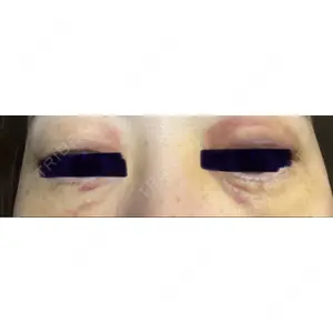 APOLLO BEAUTY CLINIC口コミ