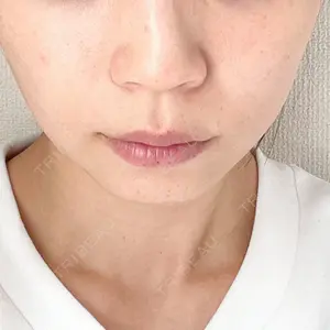 L‘amour clinic Tokyo【ラムールクリニック東京】口コミ