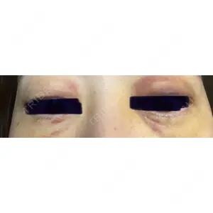 APOLLO BEAUTY CLINIC口コミ