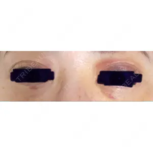 APOLLO BEAUTY CLINIC口コミ