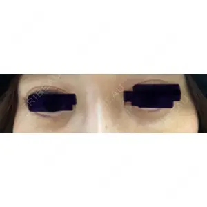 APOLLO BEAUTY CLINIC口コミ