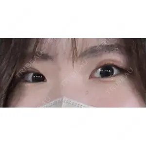 BLINC CLINIC （ブリンク クリニック）口コミ