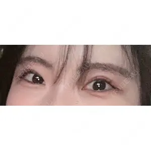 BLINC CLINIC （ブリンク クリニック）口コミ