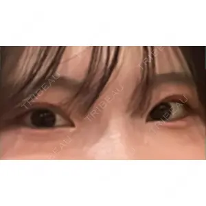 BLINC CLINIC （ブリンク クリニック）口コミ