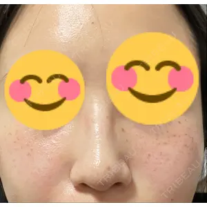 神楽坂美容クリニック タテバ芍薬口コミ