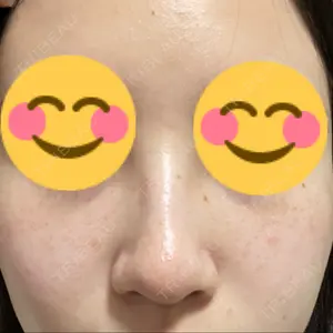 神楽坂美容クリニック タテバ芍薬口コミ