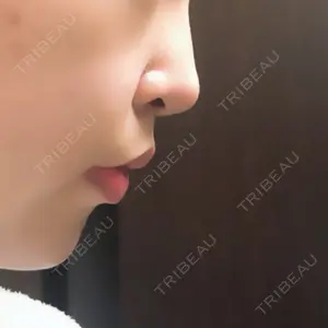 口コミ
