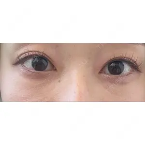 X CLINIC X CLINIC 銀座院口コミ