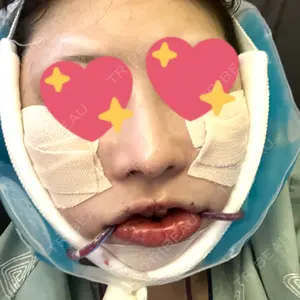 セギム美容整形外科口コミ