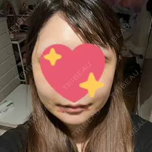 セギム美容整形外科口コミ