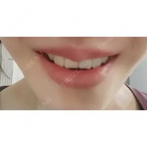 ビューティースキンクリニック ビューティースキンクリニック 新宿院口コミ
