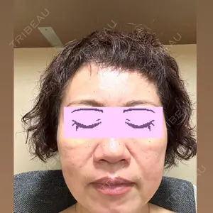 CHARIS BEAUTY CLINIC口コミ