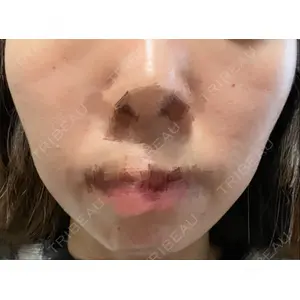 A CLINIC（エークリニック） A CLINIC（エークリニック） 横浜院口コミ